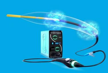 【医技领航】告别“心头大石”：Shockwave振波球囊为冠脉钙化患者打通生命通道
