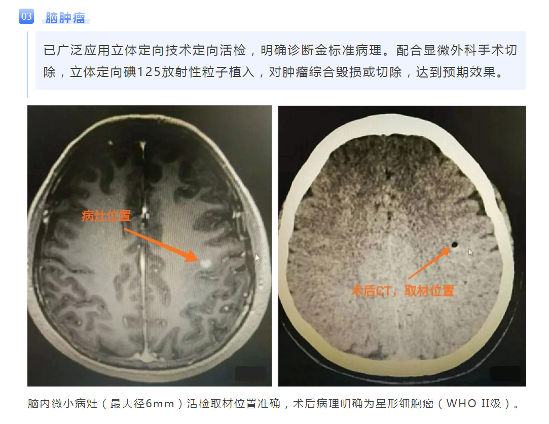 WeChat Screenshot_20201102161716.png